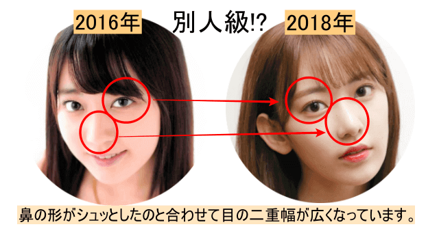 宮脇咲良二重整形・鼻尖整形が濃厚な2018年と2016年を比較