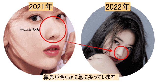 宮脇咲良鼻の整形耳介軟骨移植が濃厚な2022年と2021年を比較